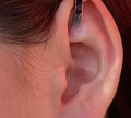 Ear Seeds